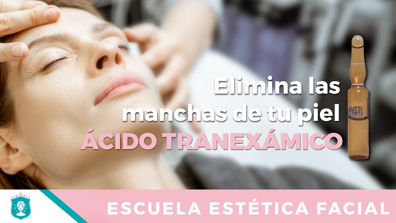 Acido tranexámico reduce el melasma y las hiperpigmentaciones para que sirve, ampolla