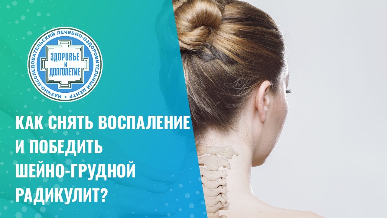 ✅ Как снять воспаление и победить шейно-грудной радикулит?