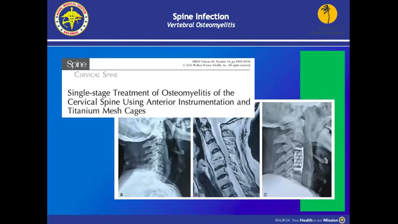 Spine Infection Management : Jessica Stambaugh, MD, on May 10, 2021 - Fellows Conference