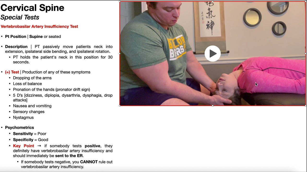 Vertebrobasilar Artery Insufficiency Test | Rationale & Interpretation