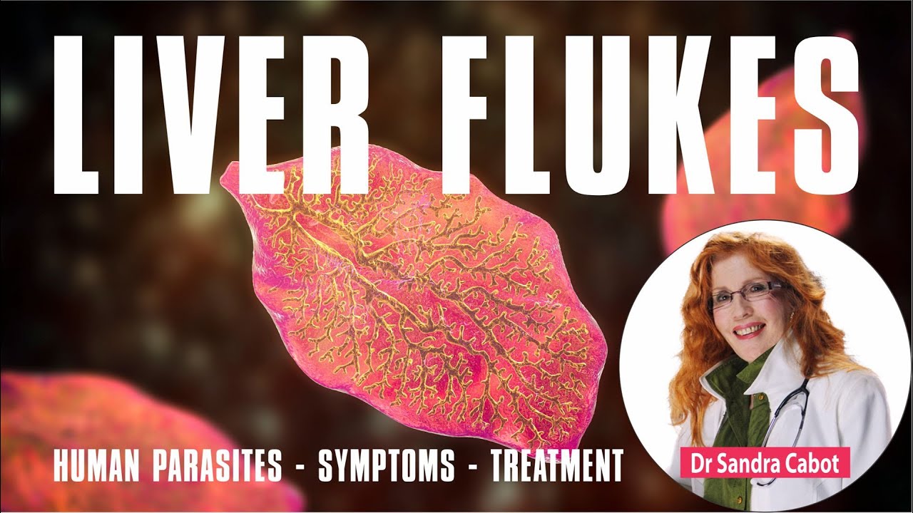 Liver Flukes | Liver Fluke Symptoms | Get rid of Liver Flukes #parasites #liverflukes