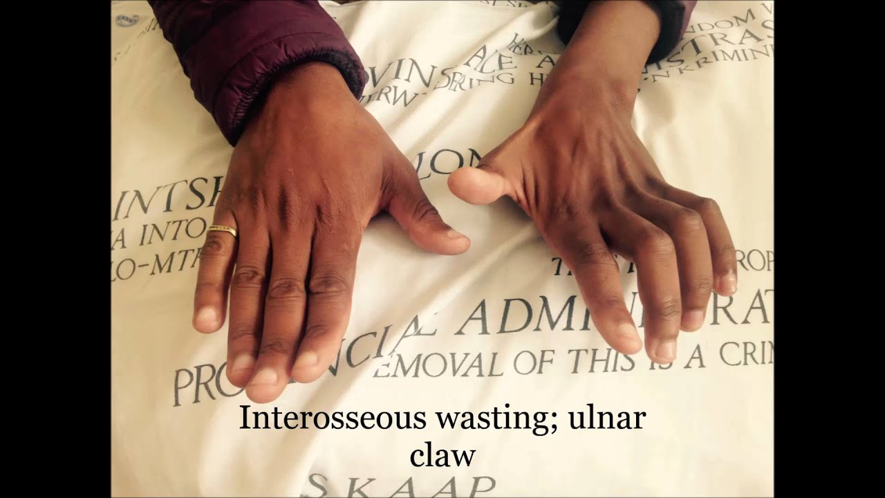 Hand Examination - Orthopaedic teaching video Cape Town