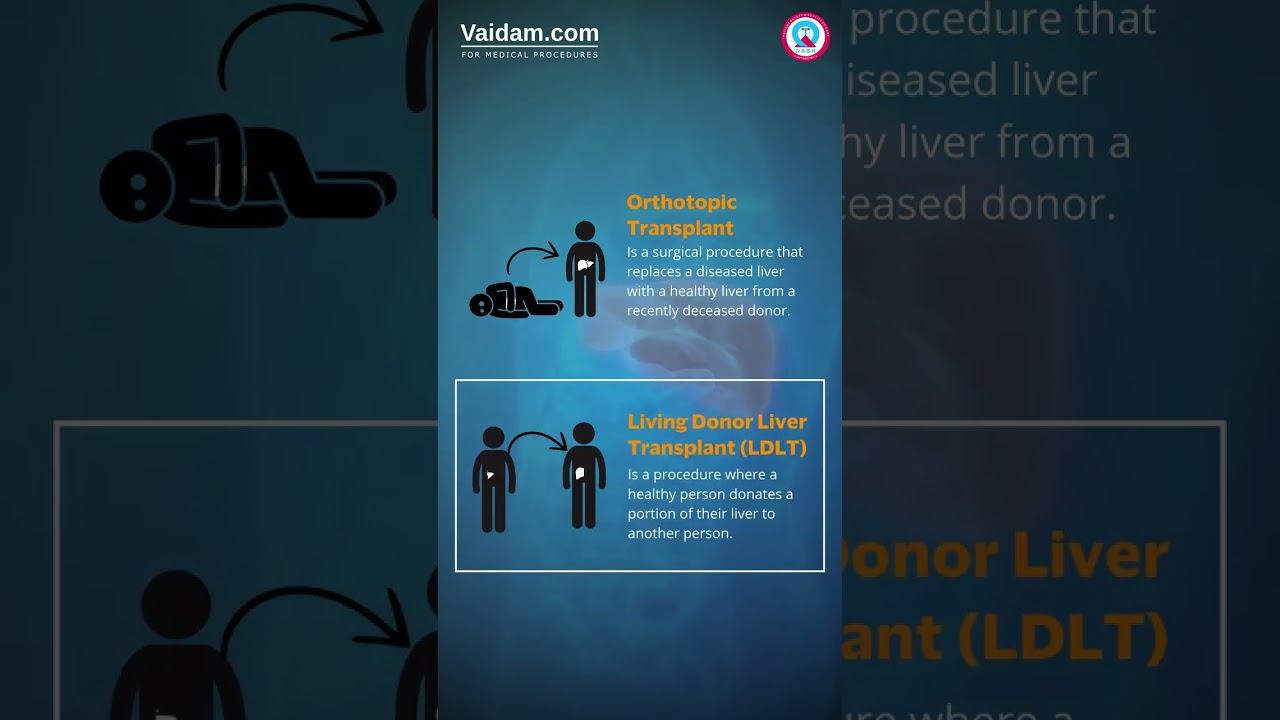 Understanding the Different Types of Liver Transplants