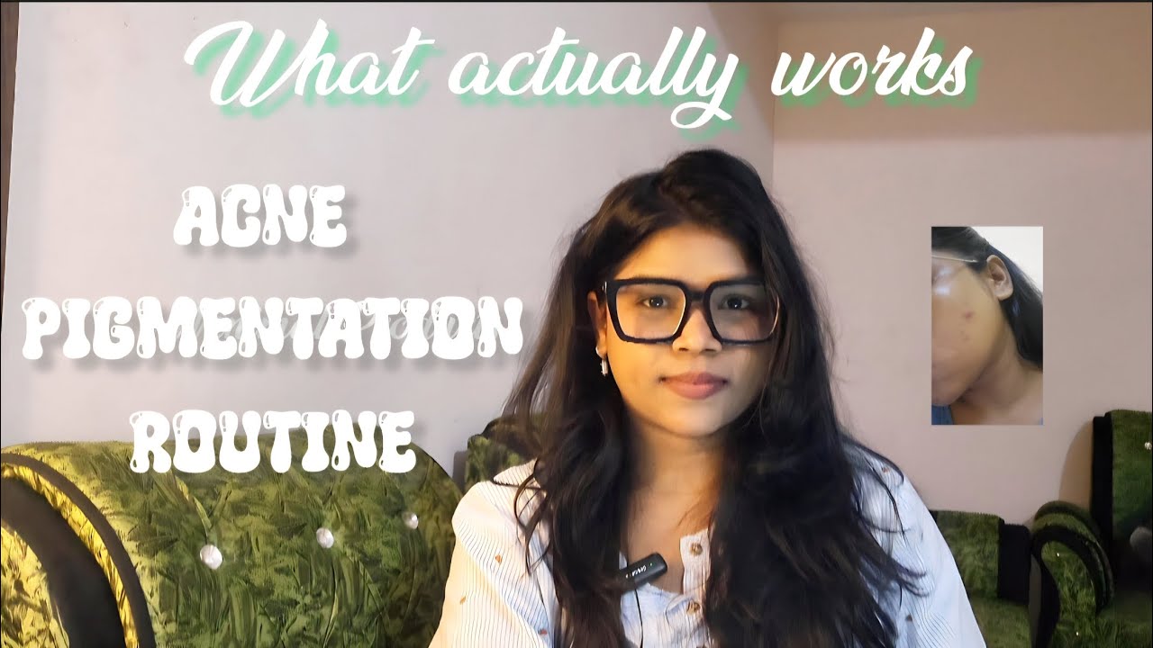 My REAL Morning Skincare Routine for Acne-Prone, Pigmented Skin | Acne &  Pigmentation Skincare