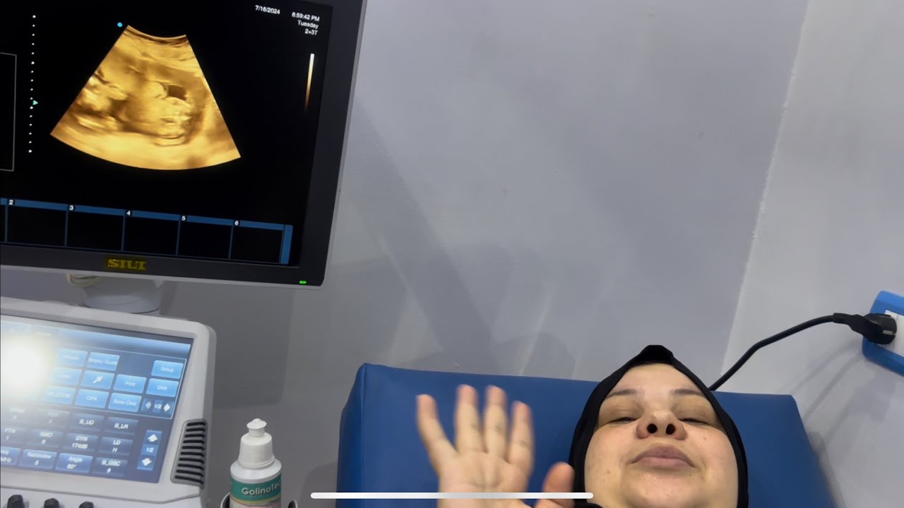 ام جني اخيرا رحنا للدكتور عشان نطمن علي البيبي ومطلعش بيبي طلع صغير زي امه وأخواته مفيش 🥳