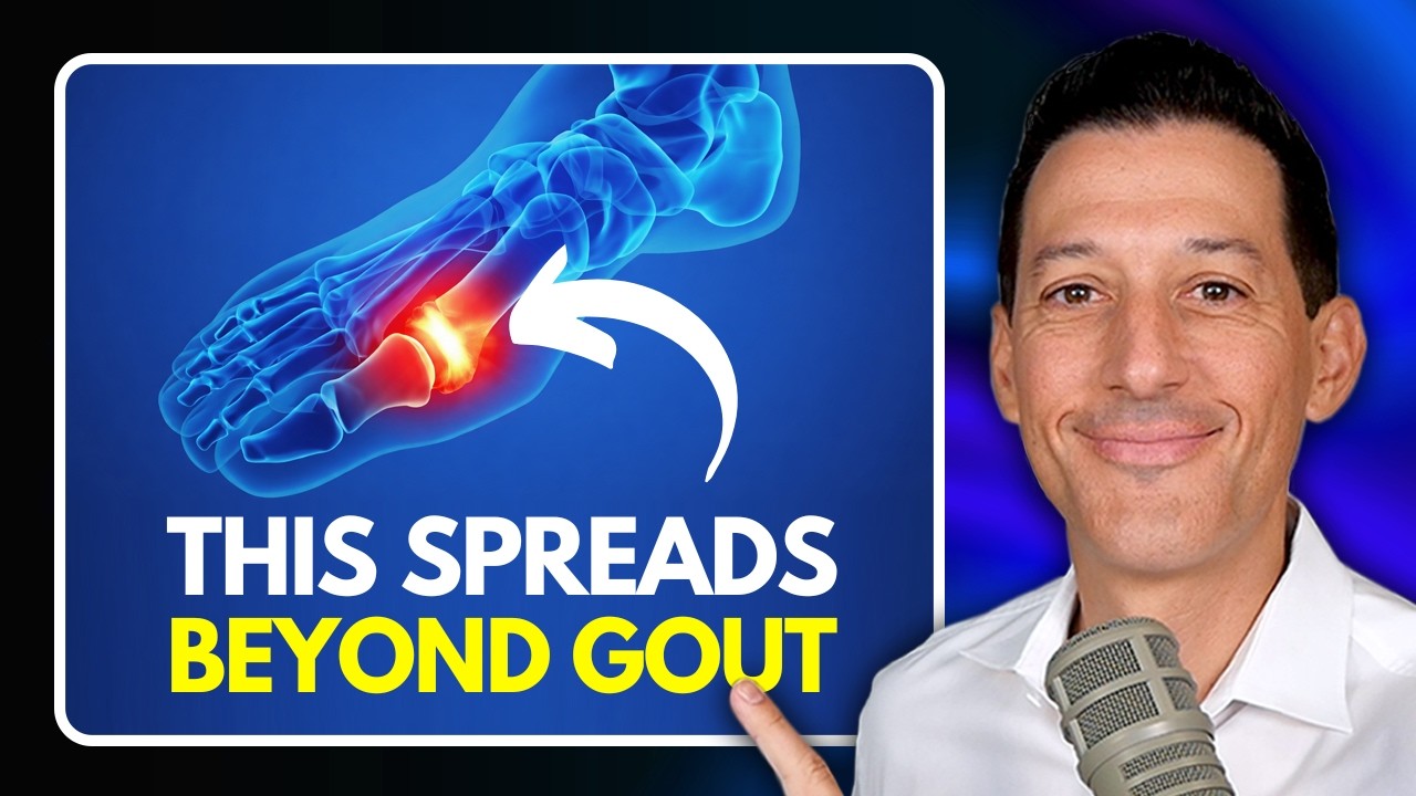 The Hidden Danger of Uric Acid (It’s Not Just Gout)