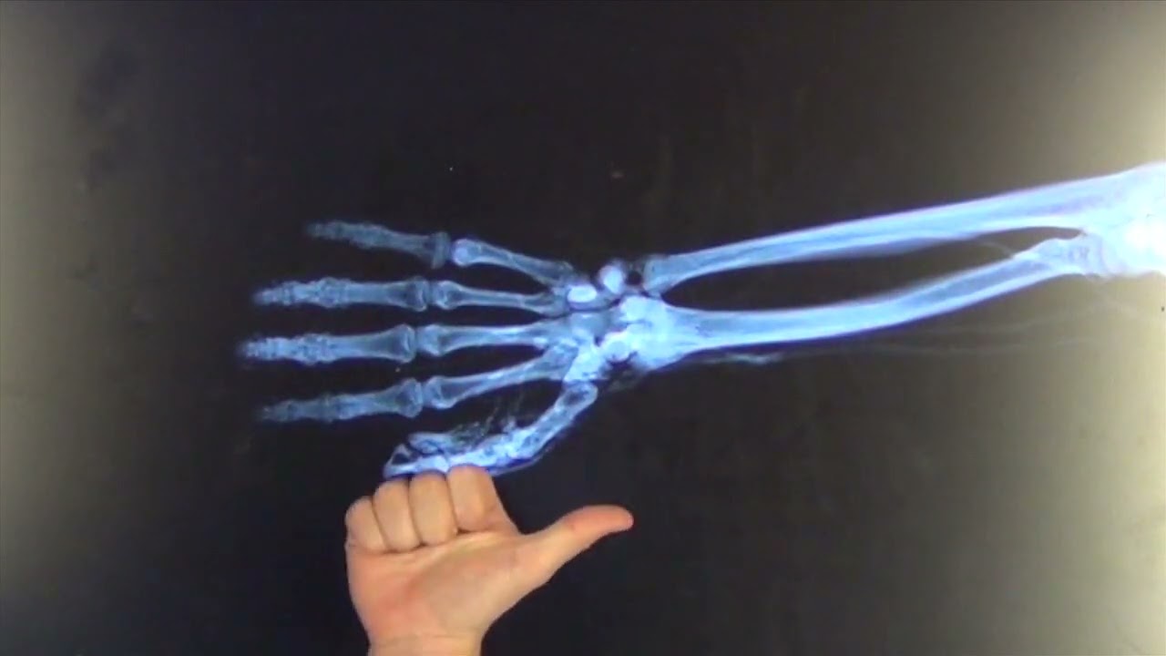 Upper Limb Review 2a