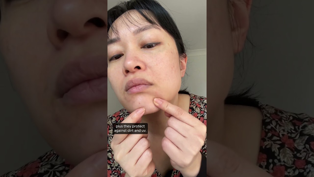 How to hide a pimple