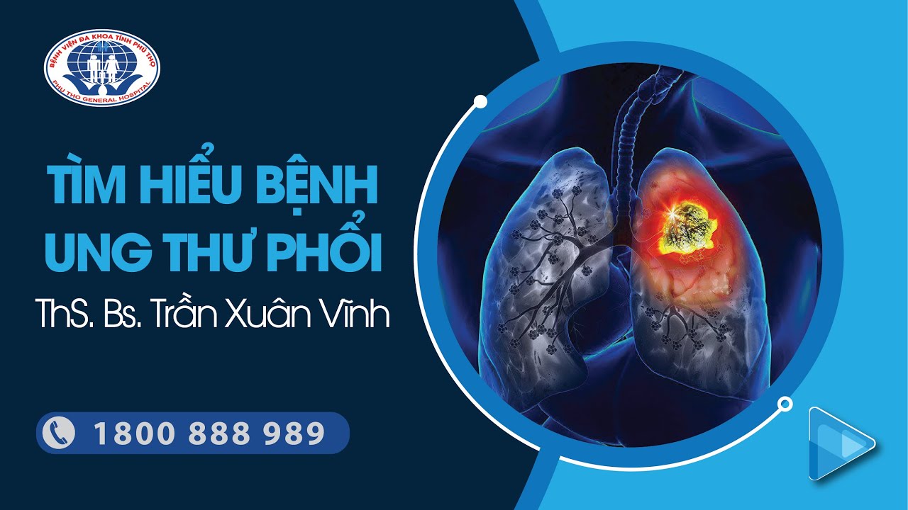 TÌM HIỂU UNG THƯ PHỔI - ThS. Bs. Trần Xuân Vĩnh - Trung tâm Ung bướu