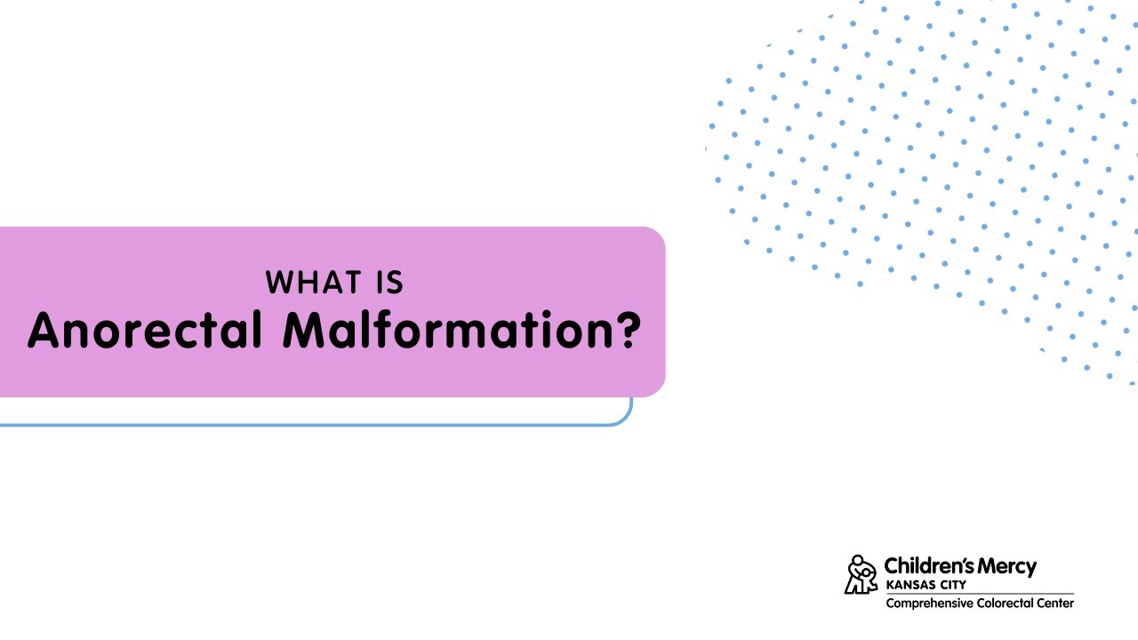 Understanding a diagnosis of Anorectal Malformation