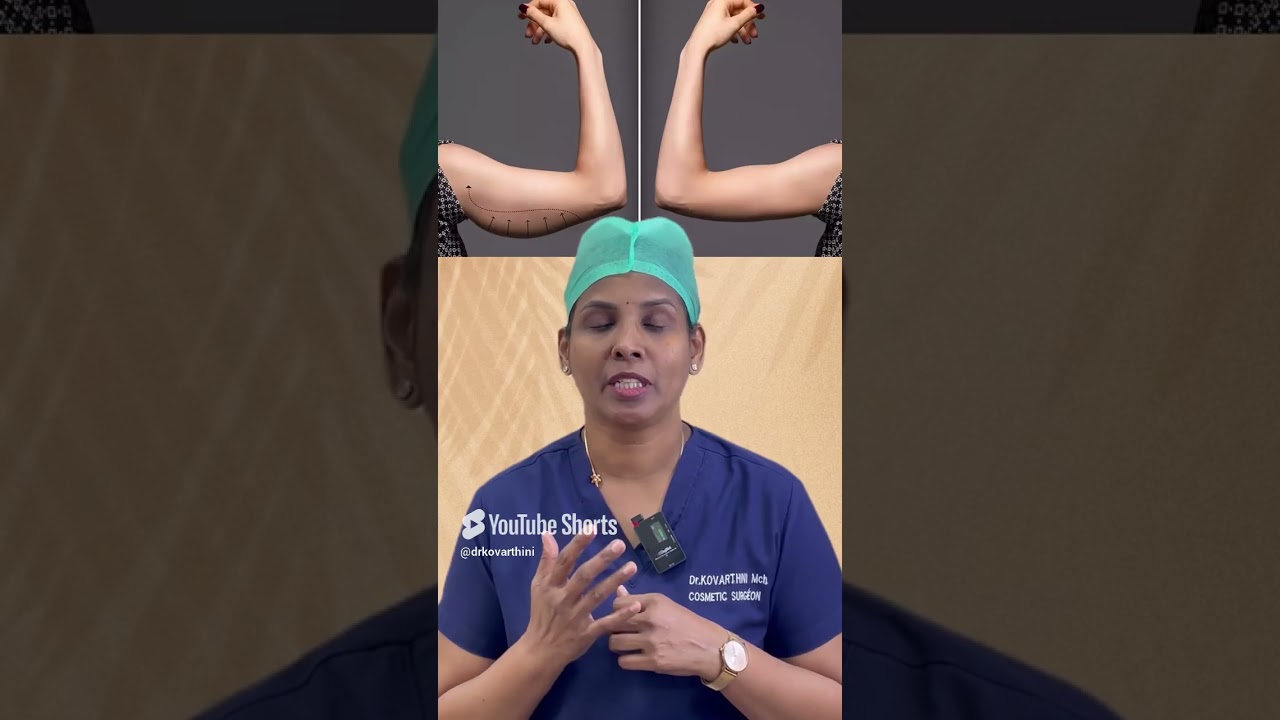 liposuction vs lift surgery   Ko Cosmetic Surgery Centre    Dr  Kovarthini