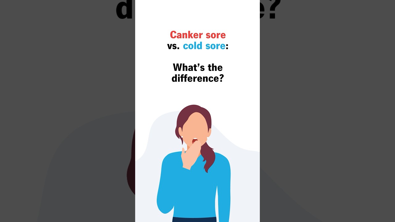 Canker sore vs cold sore: What's the difference?