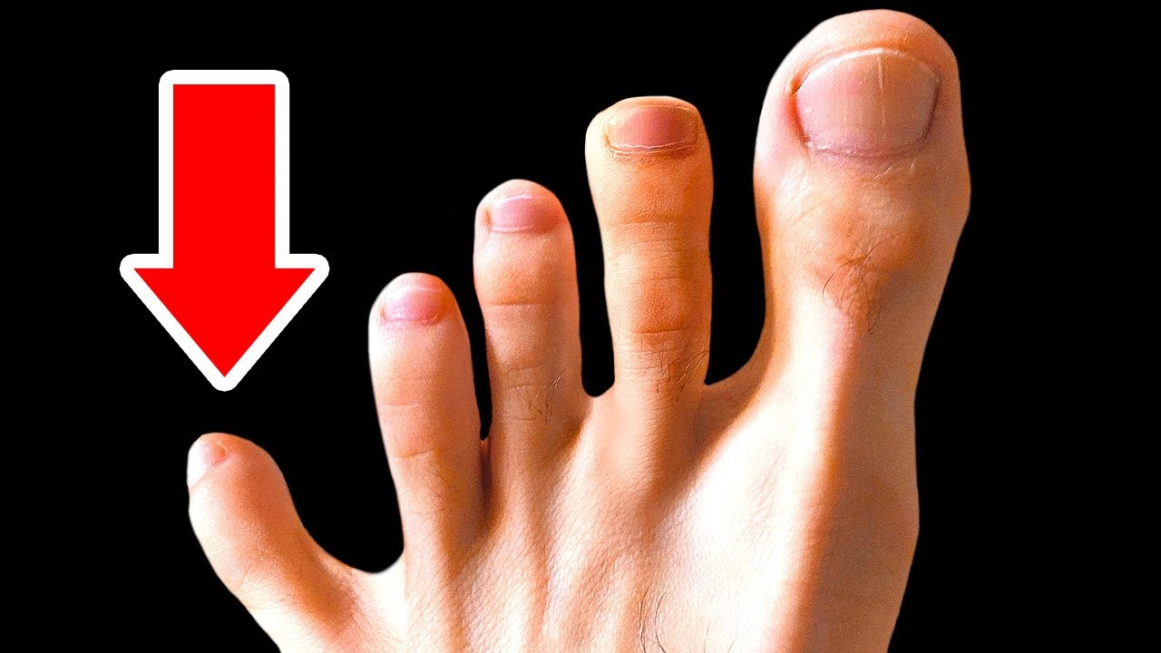 Niemand braucht 5 Zehen oder diese 14 Körpermerkmale