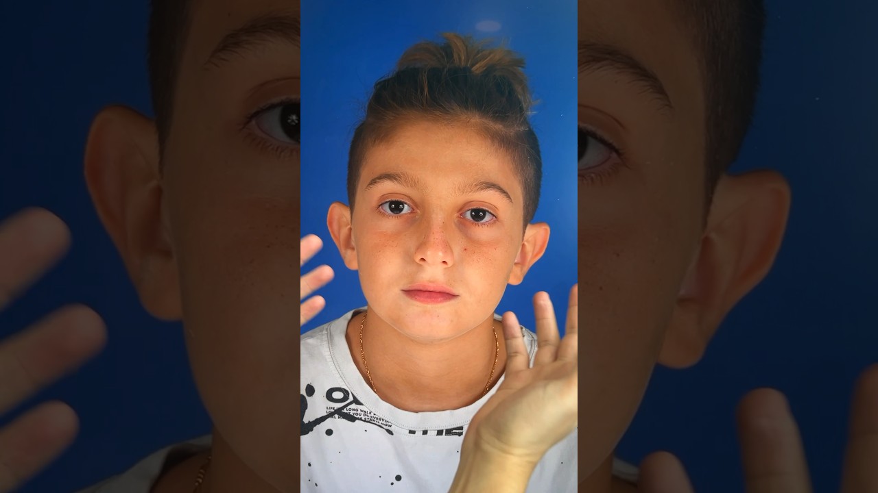 Experiencia y resultado inmediato de la #otoplastia de Mason, para corregir sus #orejasprominentes