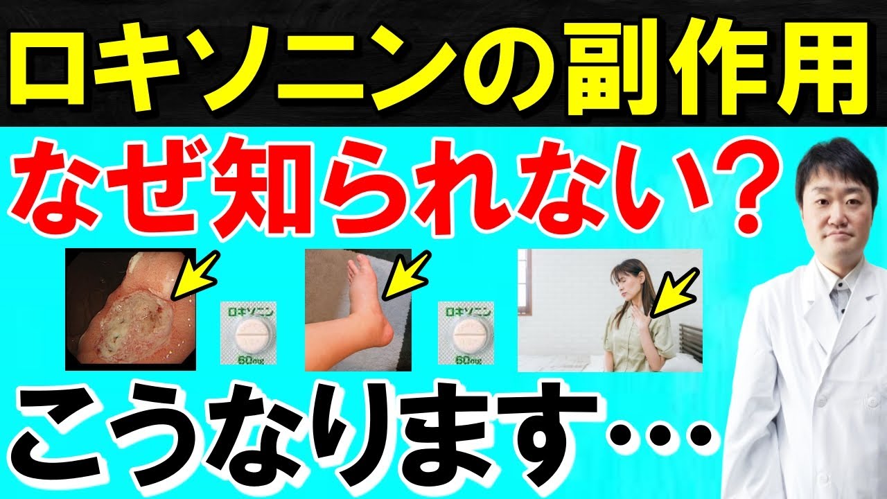 【まさか】ロキソニンや解熱鎮痛薬を毎日飲み続けると起こる体の6つの変化　頻繁に使用し続けると起きる意外な副作用とは　湿布も要注意？　痛み緩和の専門医師が解説