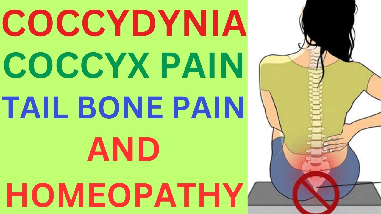 COCCYX PAIN || COCCYDYNIA || TAIL BONE  PAIN || BEST HOMEOPATHIC MEDICINE FOR COCCYDYNIA !