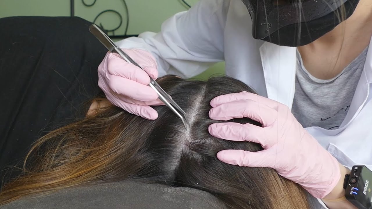 ASMR 1 HR of SCALP and LICE Checks Compilation 🤍 (Real Person)