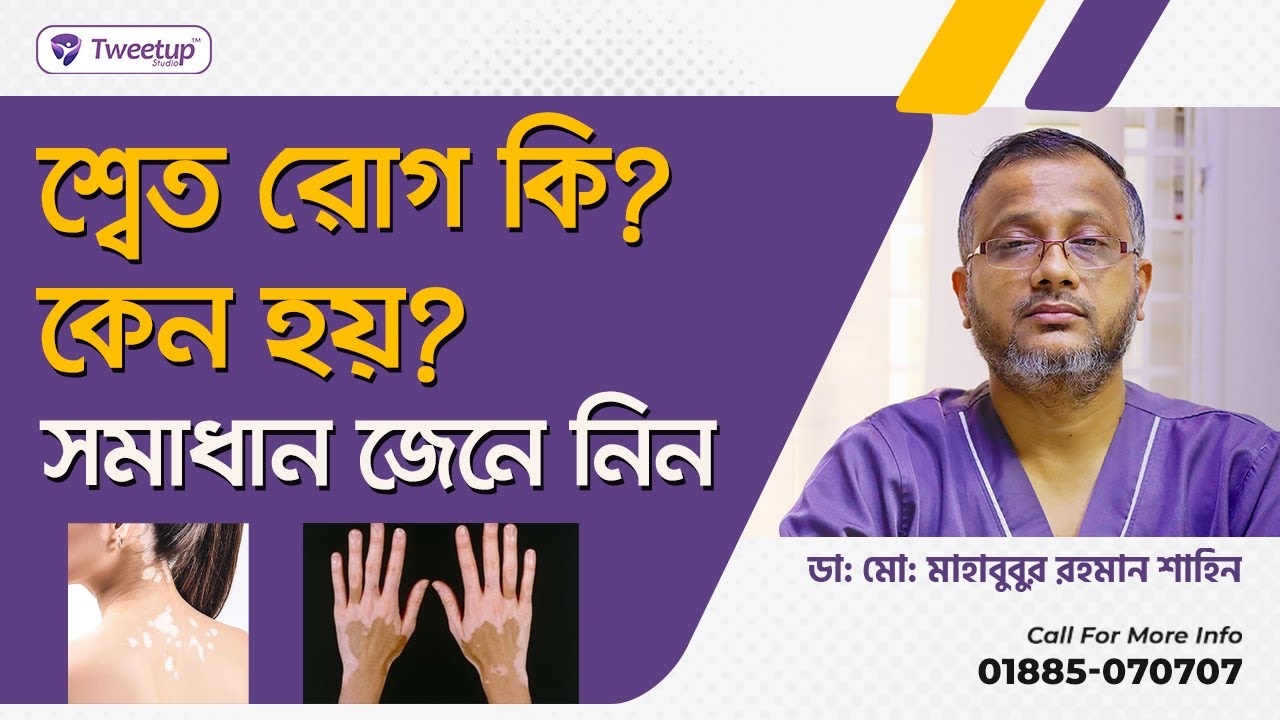 শ্বেত রোগ কি ? কেন হয় ? সমাধান কি ?।। What is leukemia? Why is that? What is the solution? (4k)