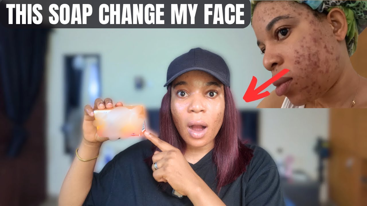 I Tried Nano Extra White Soap For 7 Days&hellip; The Result Shocked Me 😱 Honest Review