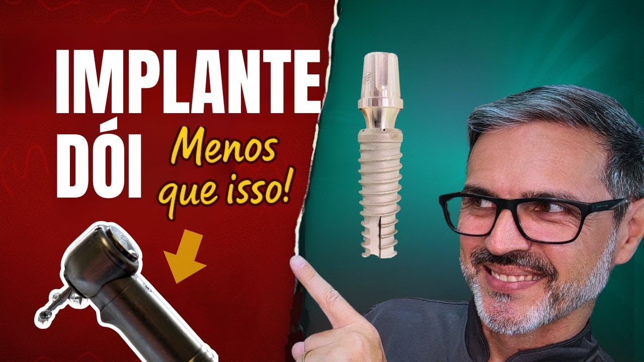 Implante Dói? A VERDADE CHOCANTE (Menos Dor que Canal!) 😱🦷