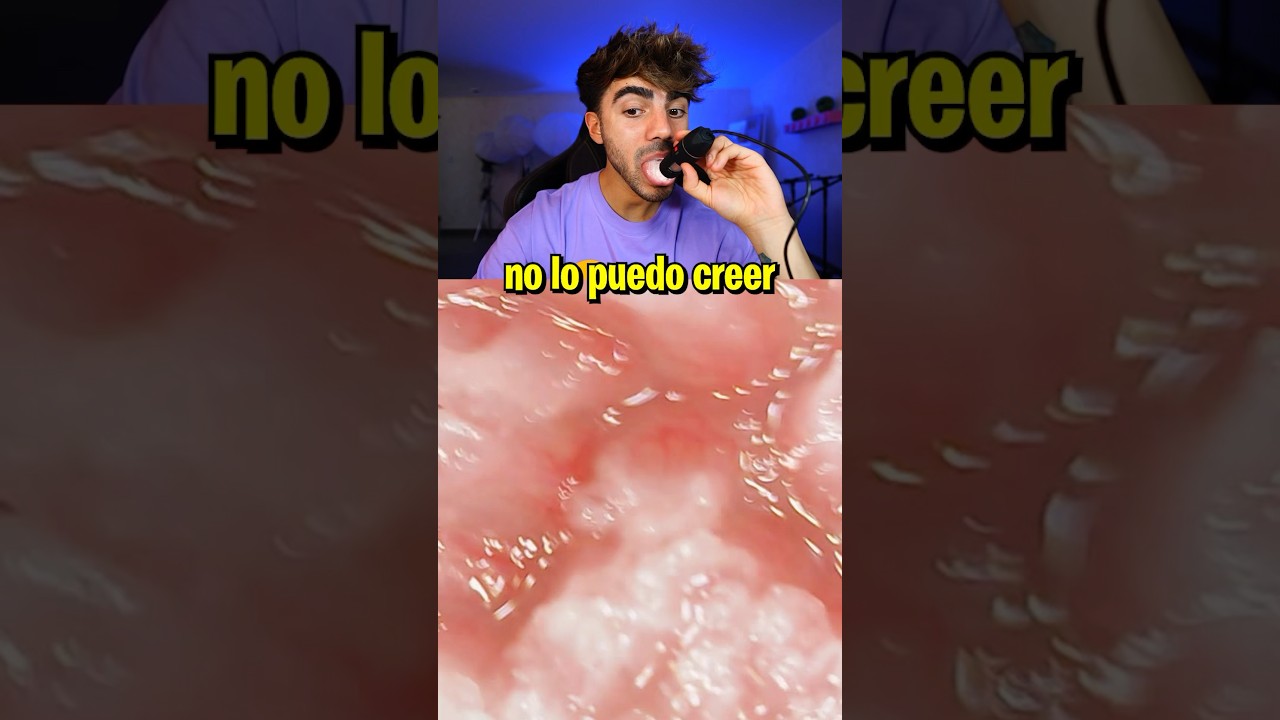 As&iacute; se ve mi lengua bajo un microscopio 😱