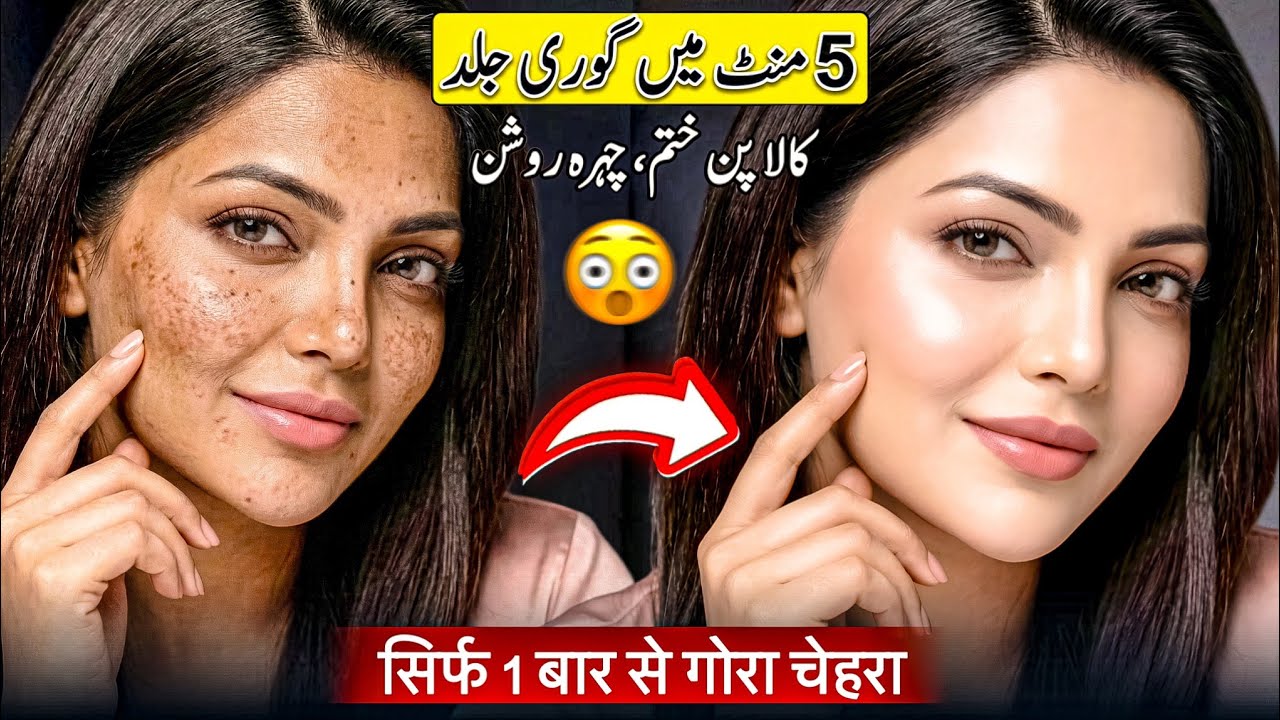 5 Minute Viral Face Pack 🔥 Tanning, Daag Or Facial Hair Remove I 10 Saal Choti Look