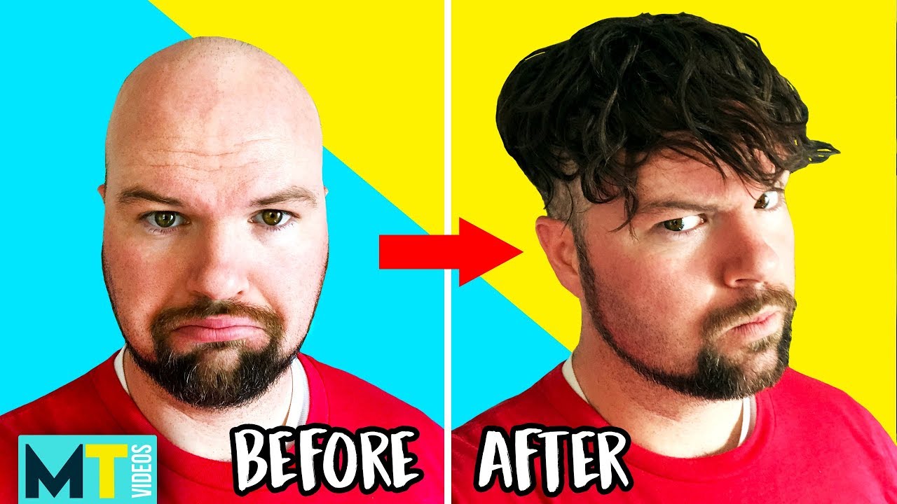 Men Try Non-Surgical Hair Replacements & Wigs - Before and After!