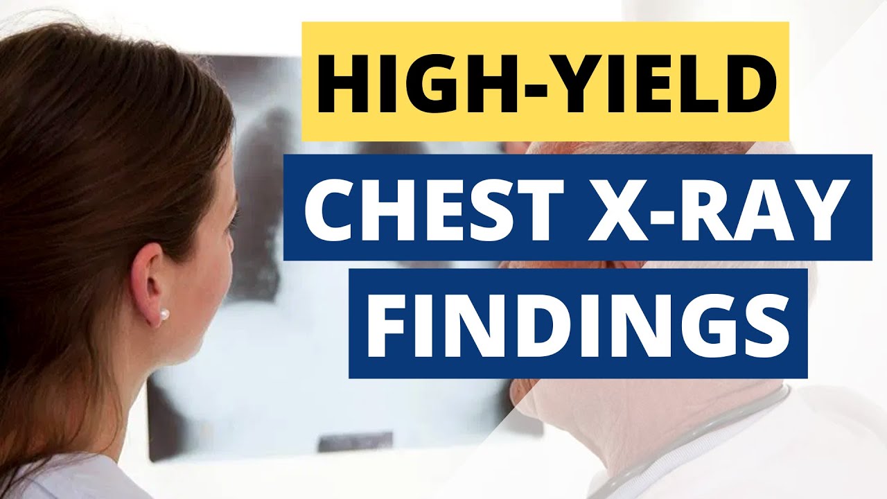 How To Read An X-Ray When Your Attending Asks - Pt 2 (High Yield Findings)