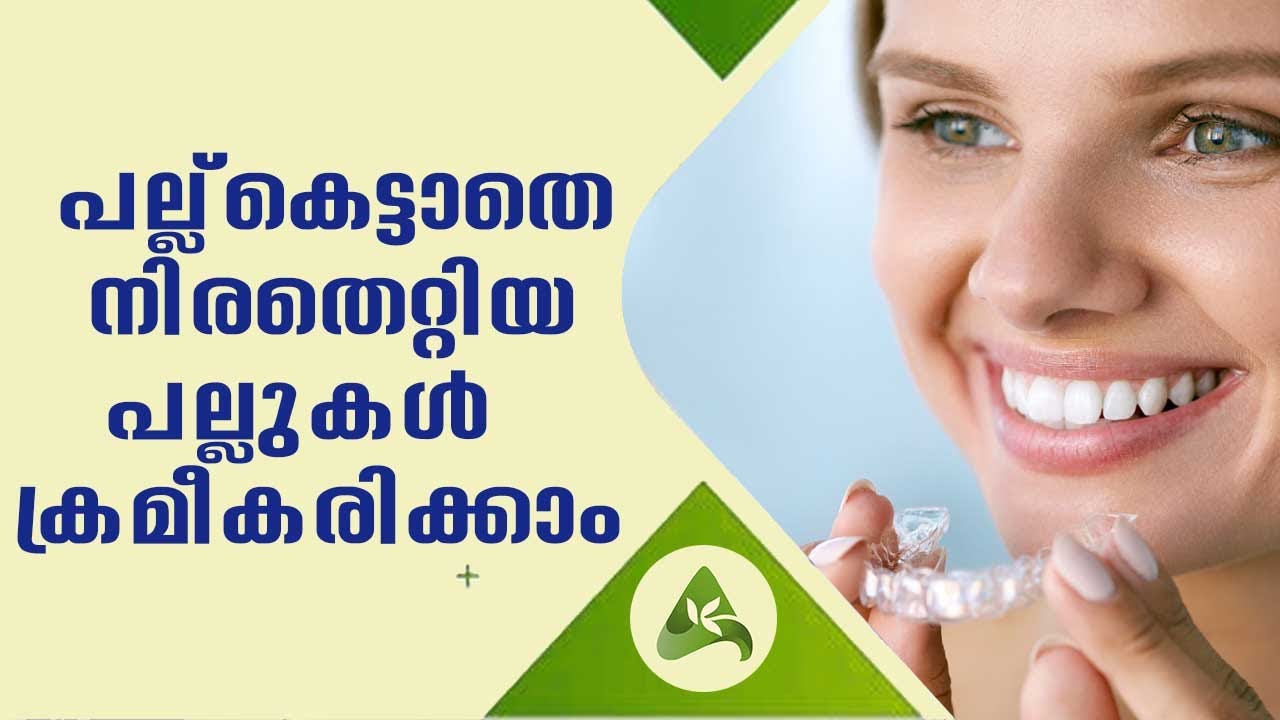 Irregular Teeth correction without Braces | Arogya Kaumudy
