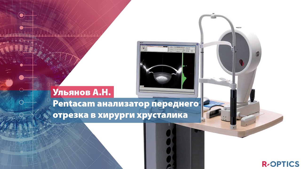 Pentacam анализатор переднего отрезка в хирурги хрусталика (Ульянов А.Н., Россия)