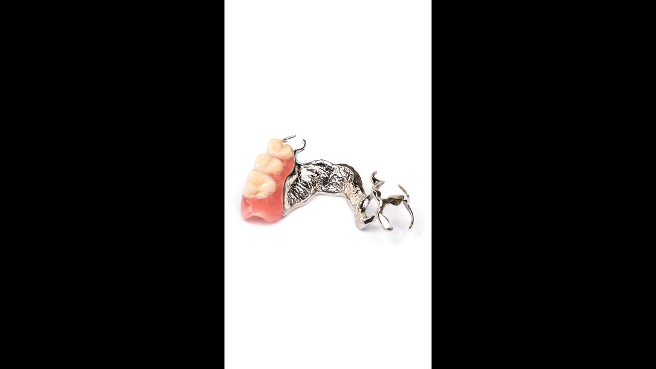Dental Implant Alternative - Partial Dentures