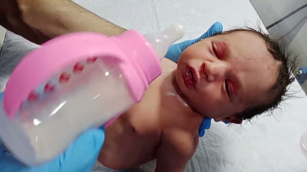 MSL Grade III Baby Management | NICU Care & Monitoring#cutbaby #newborncare #babyhealth 