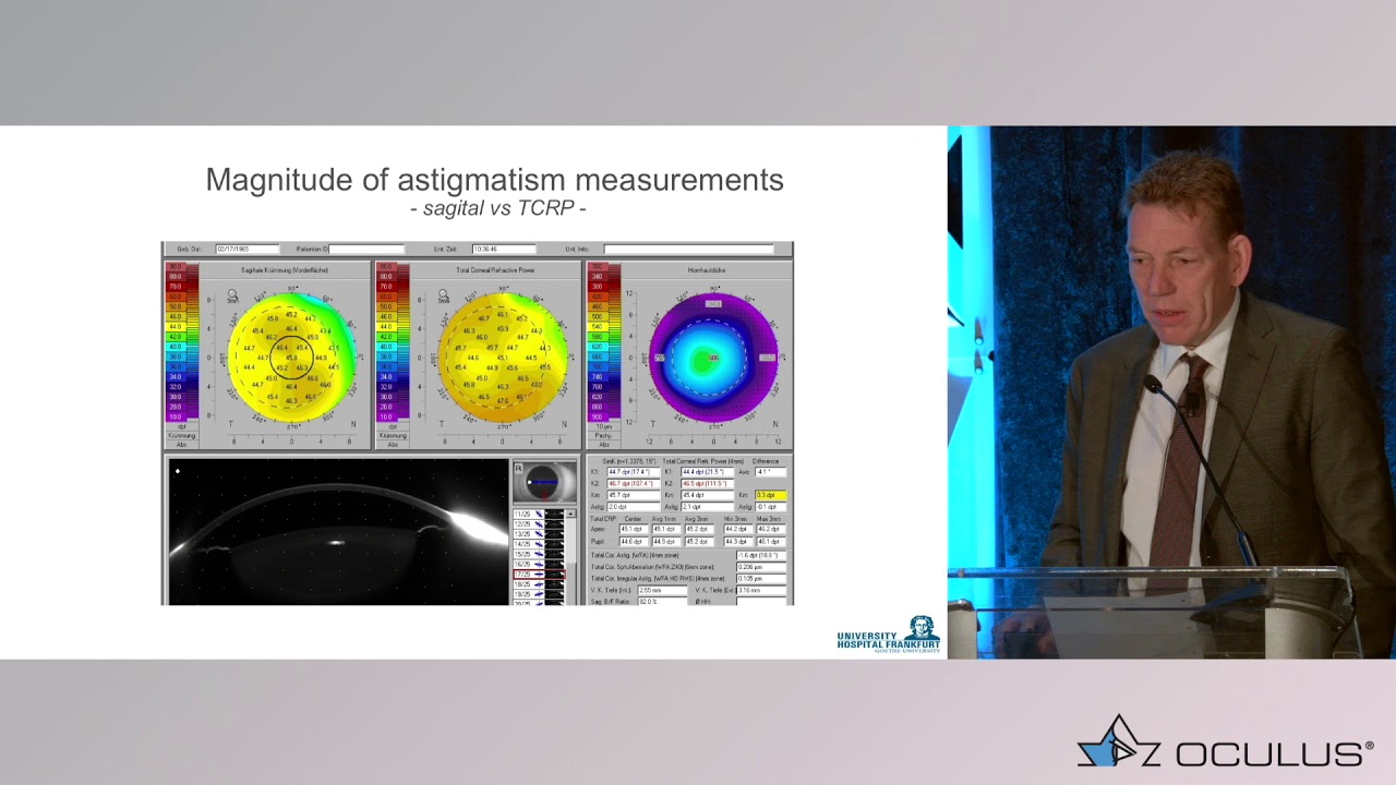 Thomas Kohnen, MD – IOL Master vs. Pentacam® AXL