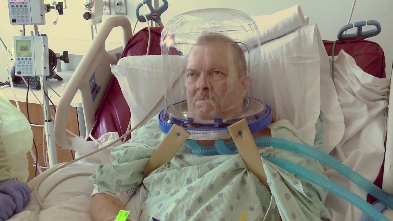Helmet Noninvasive Ventilation