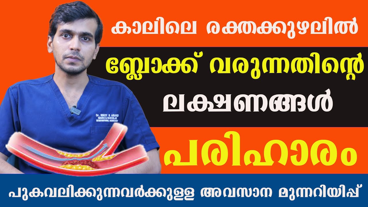 കാലിലെ രക്തക്കുഴലിൽ ബ്ലോക്ക് വരുന്നതിന്റെ ലക്ഷണങ്ങൾ പരിഹാരം .Dr Rinoy R Anand