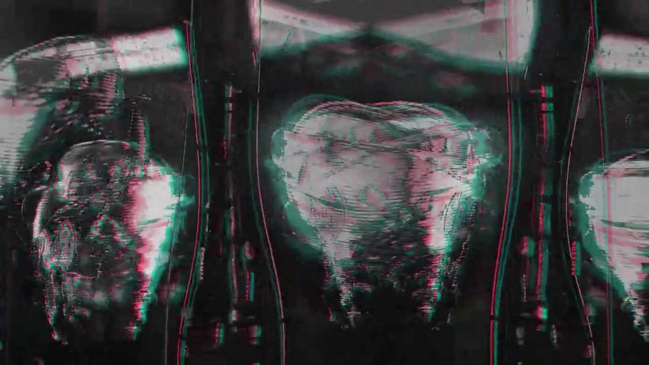 WZX_O & Joele Basili - We Are Dreamers (Lil Peep - beamer boy remix)