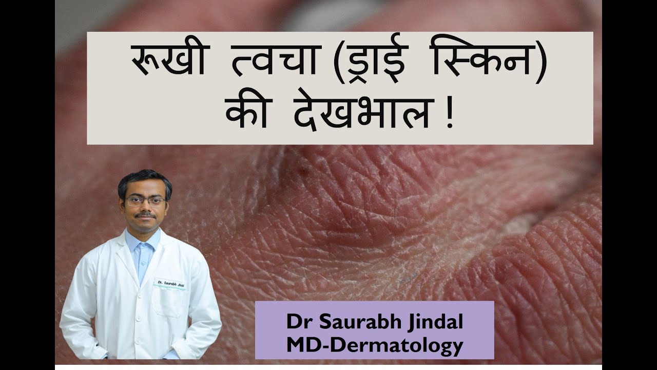 Dry skin -रूखी त्वचा (ड्राई स्किन) की देखभाल के लिए बेहतरीन उपाय