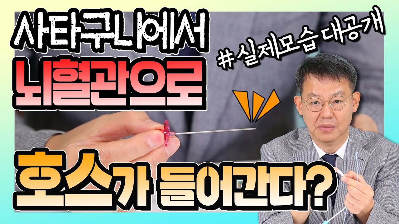 '뇌혈관 조영술' 이렇게 하는 겁니다 - 신경외과 신사부 #26