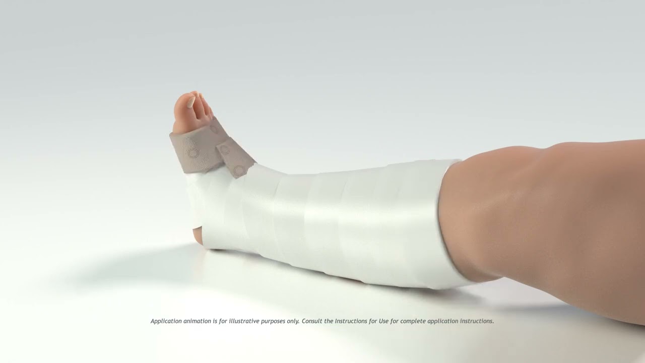 AndoFlex TLC Venous Leg Ulcer Management Animation