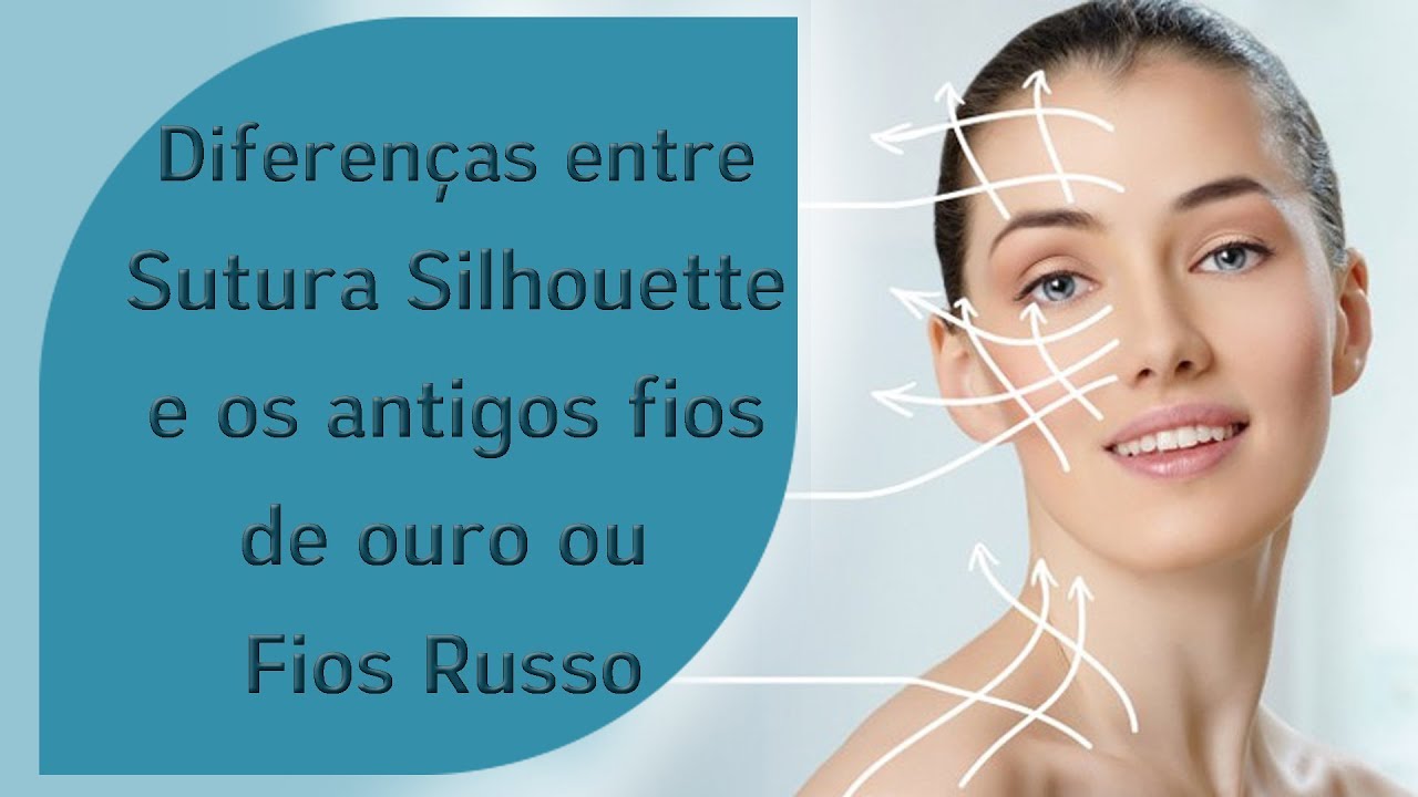 Diferen&ccedil;as entre Sutura Silhouette  e Fios de Ouro ou Fios Russo