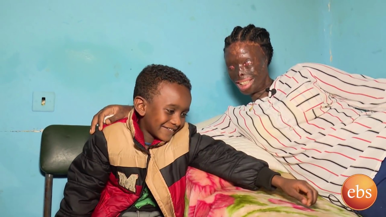 አዲስ ህይወት (በባለቤቷ አሲድ የተደፋባት የልጅ እናት ክፍል 1/New Life Ep 217