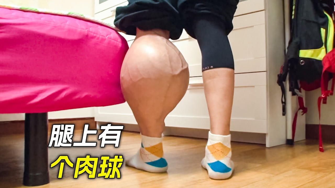 男人腿上有個肉球，每走一步都非常痛苦，電影，解說，獵奇，懸疑，冒險，短片，short films