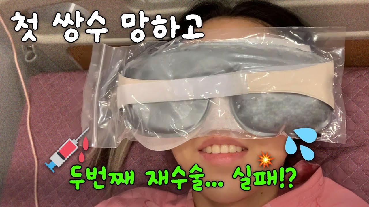 [희연 Vlog] 소세지 눈 재수술 N번째...😤 짝눈, 두줄따기 !! 쌍수 고민중이라면 이 영상을 클릭해주세요 (수술당일~한달차까지)