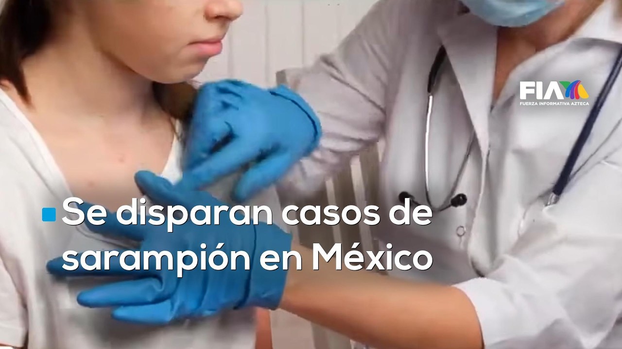 Alerta sanitaria por sarampión en México