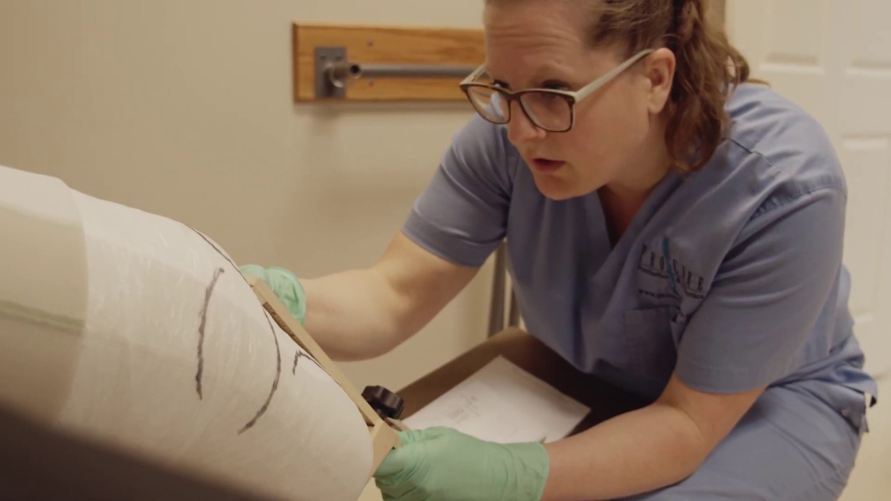 ProCare's Casting and Fitting Process