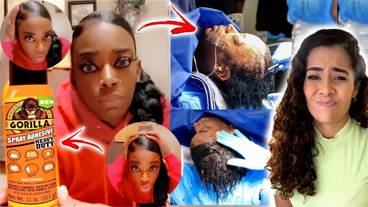 A MENINA QUE COLOU O CABELO COM COLA INDUSTRIAL !