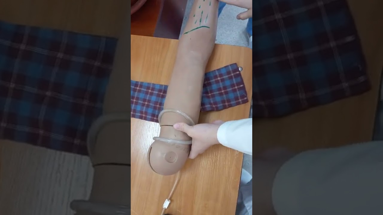 Уақытша қан кетуді тоқтату. Жгут салу| Алгоритм временной остановки кровотечение