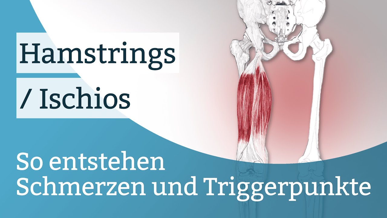 Hamstrings / Ischio Schmerzen, Triggerpunkte und deren Aktivierung