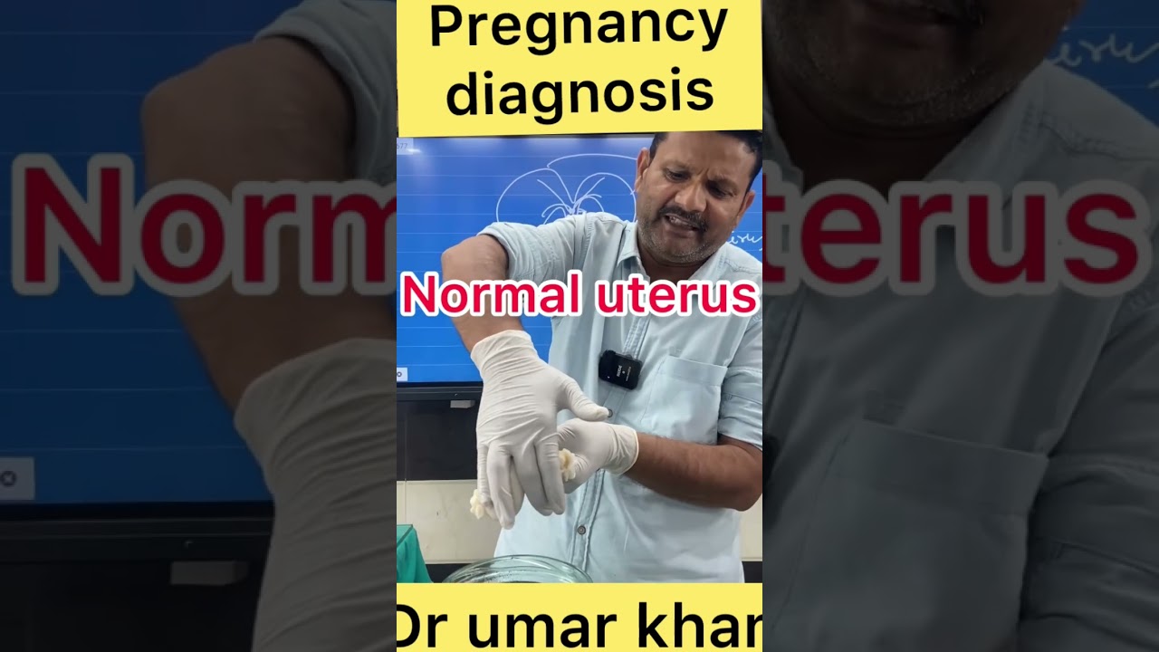 Pregnancy diagnosis l dr umar khan