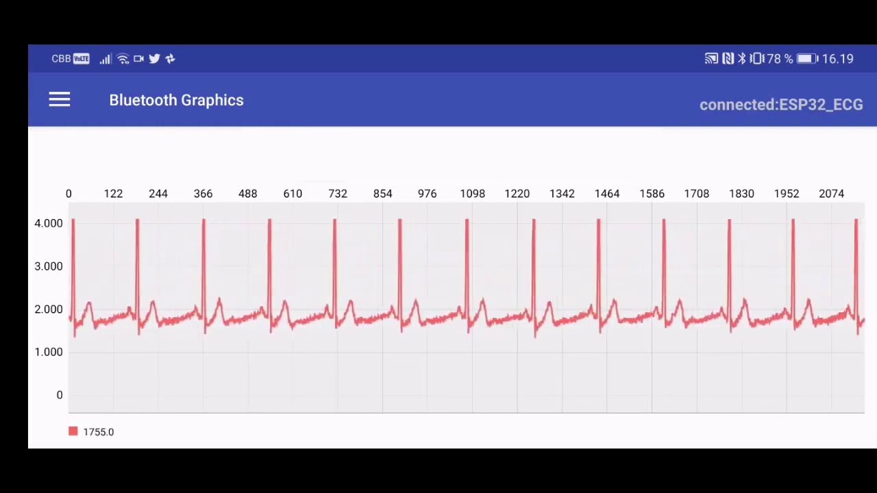 ESP32 AD8232 Arduino Bluetooth ECG (simple)